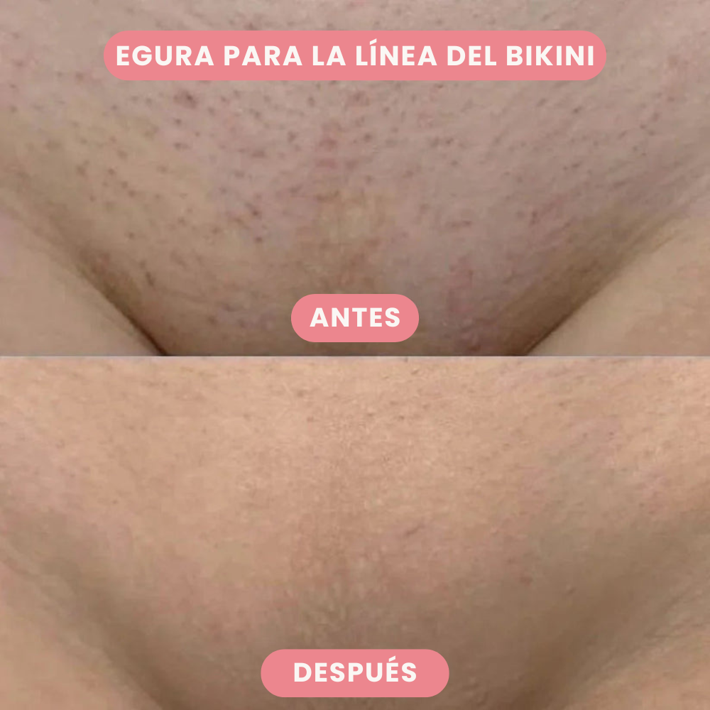 SkinTrim - Recortadora 2 en 1 para la Línea del Bikini y el Rostro