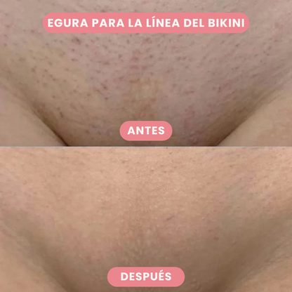SkinTrim - Recortadora 2 en 1 para la Línea del Bikini y el Rostro
